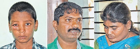 தவறான சிகிச்சையால் சிறுவன் பாதிப்பு: தருமபுரியில் 3 போலி மருத்துவர்கள் கைது