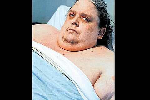 உலகின் குண்டு மனிதர் மறைந்தார்