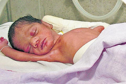 சிசு மரணங்கள் ஏன்?