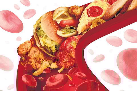 எந்த கொலஸ்ட்ரால் நல்லது? எந்த கொலஸ்ட்ரால் கெட்டது?