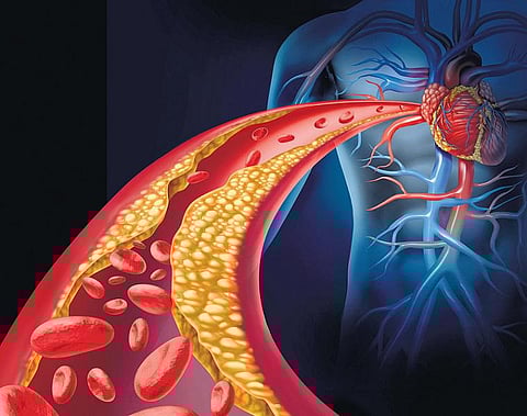 கொழுப்பு அதிகமாகிப் போச்சா?