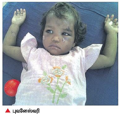 கடன் பாக்கிக்காக குழந்தைக்கு சூடு: திருப்பத்தூர் தம்பதி மீது வழக்கு பதிவு