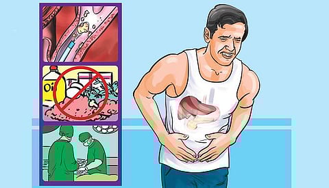 பித்தப் பையில் கல் உண்டாவது ஏன்?