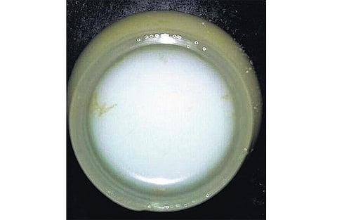 ‘நெஸ்லே தயாரிப்பு பால் பவுடரில் புழுக்கள், வண்டுகள்’: கோவை ஆய்வுக்கூடத்தில் கண்டுபிடிப்பு