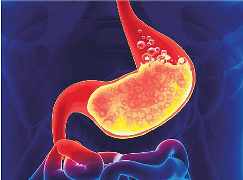 நலம் நலமறிய ஆவல்: உற்சாகத்தைக் குறைக்கும் அஜீரணம்