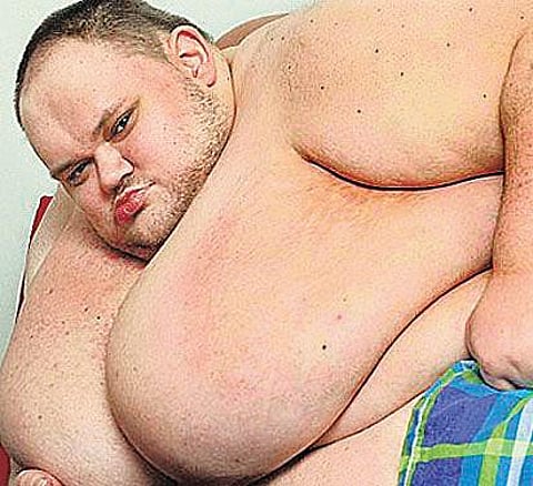 பிரிட்டனின் குண்டு மனிதர் மரணம்