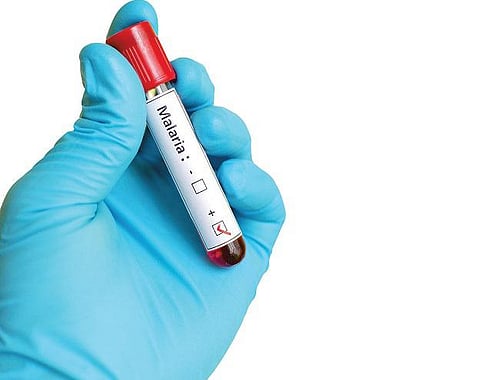 பரிசோதனை ரகசியங்கள் 10: மலேரியா காய்ச்சலுக்கு என்ன பரிசோதனை?