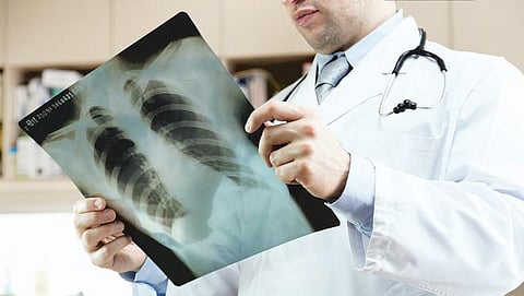 பரிசோதனை ரகசியங்கள் 12: நிமோனியா காய்ச்சலுக்கு என்ன பரிசோதனை?