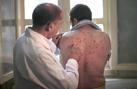 காஷ்மீரில் பெல்லட்டுகளினால் இதுவரை 3,000 பேர் காயம்