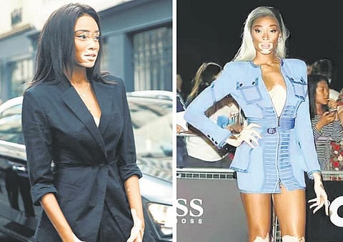 பக்கத்து வீடு: தோல் என் அடையாளமல்ல!