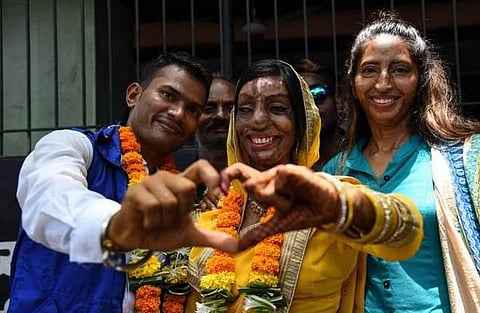 ஆசிட் வீச்சால் பாதிக்கப்பட்டவரின் இனிய குரலால் கவரப்பட்டு, அவரையே திருமணம் செய்த சிசிடிவி ஆபரேட்டர்