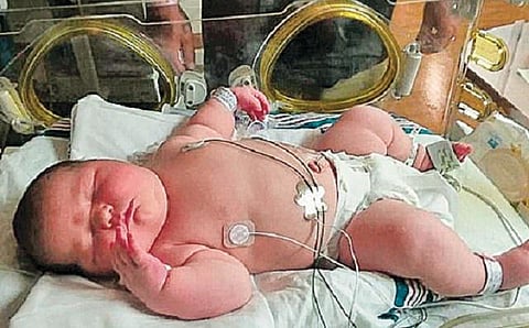 உலக மசாலா: இரண்டு குழந்தைகளின் எடையில் ஒரு குழந்தை!