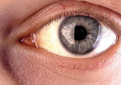 இனிப்பு தேசம் 14: காக்கப்படாத கண், கண்ணல்ல