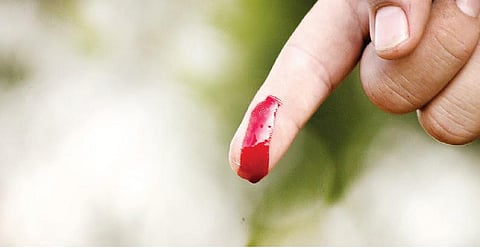 உலக ஹீமோபிலியா தினம் - ஏப்ரல் 17: நில்லாமல் வடியும் குருதி