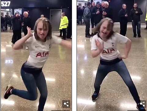 கிண்டலுக்கு ஆளான 16 வயது சிறுமியின் நடனம்: டவுன் சிண்ட்ரோம் பாதிப்பை அறிந்து மன்னிப்பு கேட்ட நெட்டிசன்கள்