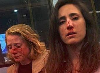 தோழிகள் இருவரை முத்தமிடக்கோரி அடி உதை: லண்டன் பேருந்தில் அதிர்ச்சிச் சம்பவம்; சமூகவலைத்தளங்களில் கண்டனம்