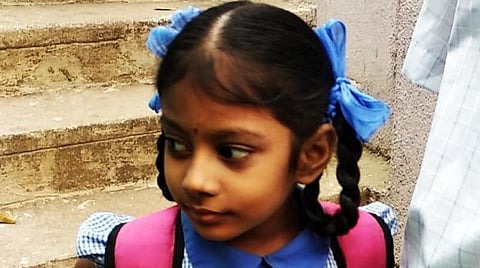 சென்னையில் டெங்கு காய்ச்சலுக்கு 2 குழந்தைகள் உயிரிழப்பு