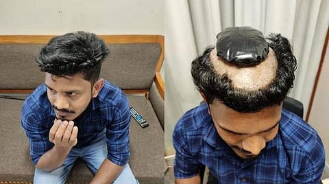 'விக்' அடியில் தங்கம்: விமான நிலையத்தில் வசமாக மாட்டிய இளைஞர்