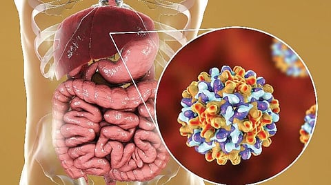 இந்தியாவின் மர்மத் தொற்றுநோய்