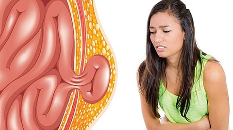 மருத்துவம் தெளிவோம் 09: தொப்புள் குடலிறக்கம் தெளிவோம்!