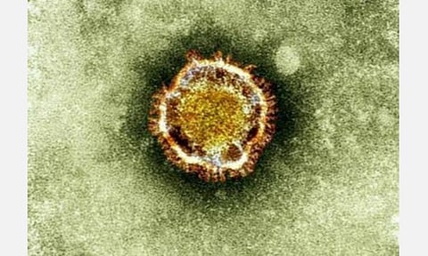 தாம்பரம் பெண்ணுக்கு கரோனா வைரஸ் பாதிப்பில்லை: அரசு பொது மருத்துவமனை டீன் ஜெயந்தி தகவல்