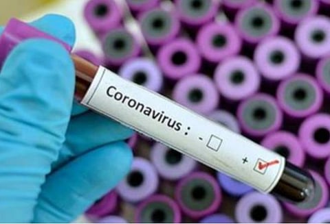 மக்களிடம் அச்சம் பரவுவதைத் தடுக்க வைரஸ் நோய் பாதிப்பு தகவல்களை ரகசியமாக வைத்திருக்க வேண்டும்: அரசுக்கு இந்திய மருத்துவச் சங்கம் வேண்டுகோள்