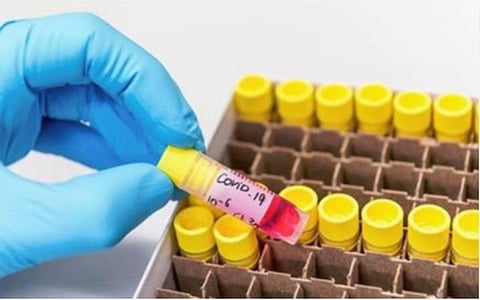 கோவிட் - 19 காய்ச்சலுக்கு மேலும் ஒருவர் உயிரிழப்பு