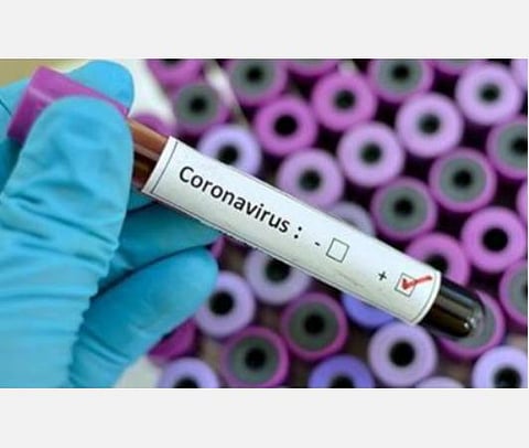 கரோனாவுக்கு அமெரிக்காவில் 22 லட்சம் பேர் பலியாகலாம், பிரிட்டனில் 5 லட்சம் பேர் மரணிக்கலாம்: பிரிட்டன் ஆய்வு ஒன்றில் அதிர்ச்சித் தகவல்