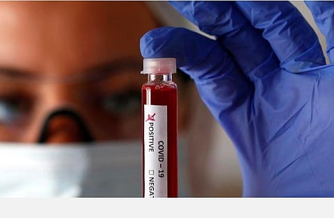 பிரதிநிதித்துவ படம். | ராய்ட்டர்ஸ்.