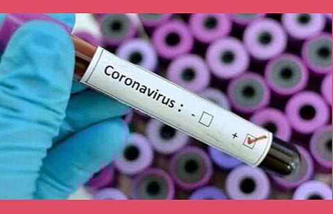 தேனியில் கரோனா தொற்றால் 53 வயதுப் பெண் உயிரிழப்பு: தமிழகத்தில் பலி எண்ணிக்கை 3 ஆனது