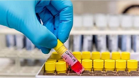 தென்காசி மருத்துவமனையில் சேர்க்கப்பட்ட 8 பேருக்கும் கரோனா தொற்று இல்லை