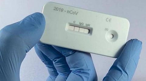 கரோனா அறிகுறிகள் உள்ள அனைவருக்கும் ரேபிட் கருவிகள் மூலம் பரிசோதனை