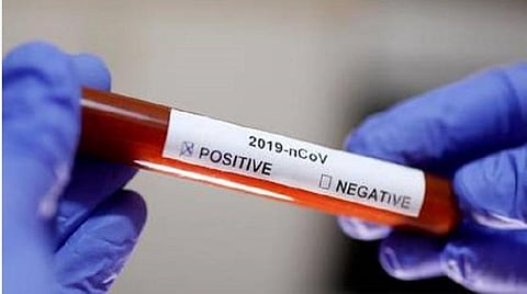 கோவில்பட்டியில் இளம்பெண் மர்ம மரணம்: ரத்த மாதிரி மருத்துவப் பரிசோதனைக்கு அனுப்பிவைப்பு