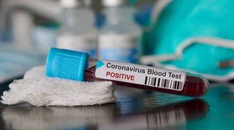 திருப்பத்தூரில் மேலும் ஒருவருக்கு கரோனா: அமைச்சர் நிவாரண நிகழ்ச்சியில் பங்கேற்றோருக்கு சிக்கல்