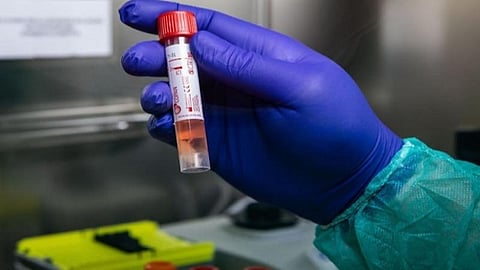 ராமநாதபுரத்தில் முதன்முறையாக கல்லூரி மாணவருக்கு கரோனா: வெளிநாடு, வெளிமாநிலம் செல்லாதவர்