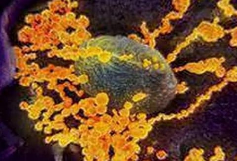 அரசு மருத்துவமனை செவிலியருக்கு கரோனா: மதுரையில் பாதிப்பு எண்ணிக்கை 56 ஆக அதிகரிப்பு