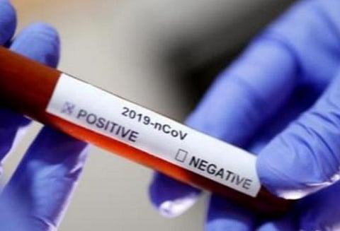 டெல்லியில் மருந்து கிடைக்காததால் 2 தமிழர்கள் இறந்தார்களா? விசாரணைக்கு வலியுறுத்தும் மாநில சிறுபான்மை ஆணையம்