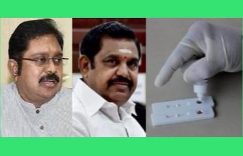 ரேபிட் டெஸ்ட் கருவிகளுக்கு கொள்ளை விலை; வெளிச்சத்துக்கு கொண்டுவந்த டெல்லி உயர் நீதிமன்றம்; அரசு வெள்ளை அறிக்கை வெளியிட வேண்டும்: டிடிவி தினகரன்