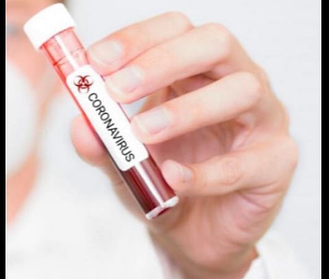 கரோனா பாதிப்பு 35 ஆயிரத்தைக் கடந்தது;24மணிநேரத்தில் ஏறக்குறைய 2 ஆயிரம் பேர் பாதிப்பு; 72 பேர் உயிரிழப்பு: மகாராஷ்டிராவில் 10 ஆயிரம் பேர் பாஸிட்டிவ்