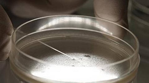 கரோனா யுத்தத்தின் ‘கேம் சேஞ்சர்’ ஆகுமா ஸ்டெம் செல் சிகிச்சை?