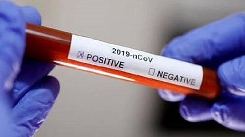 தென்காசி மாவட்டம் புளியங்குடியில் ஒரே நாளில் 9 பேருக்கு கரோனா தொற்று