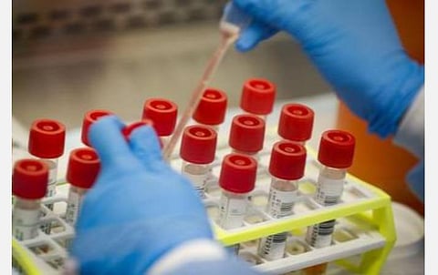 திருவள்ளூர் மாவட்டத்தில் ஒரேநாளில் 75 பேருக்கு கரோனா தொற்று உறுதி