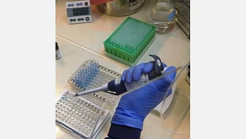 11 லட்சம் ‘பிசிஆர் கிட்’களுக்கு தமிழக அரசு ஆர்டர்