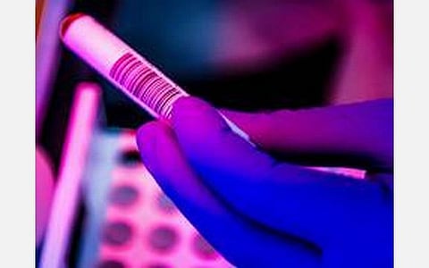 பிரதிநிதித்துவ படம்.