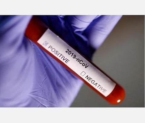 இந்தியாவில் கரோனா பாதிப்பு எண்ணிக்கை 74,281- கடந்த 24 மணி நேரத்தில் 3525 புதிய தொற்றுக்கள்- 2,415 பேர் பலி