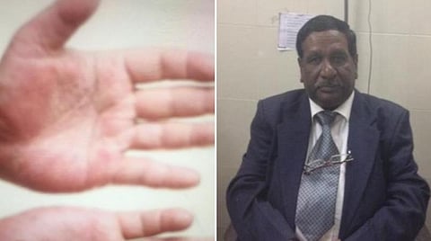 கரோனா காலத்தில் சரும நோய்கள் : எளிதான தீர்வு