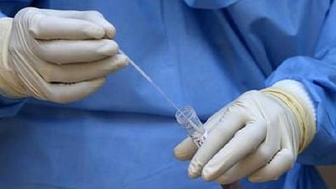 மதுரையில் அடிதடி வழக்கில் சிக்கியவருக்கு கரோனா: சிறைக்கு அழைத்துச் சென்ற போலீஸாருக்கு சோதனை