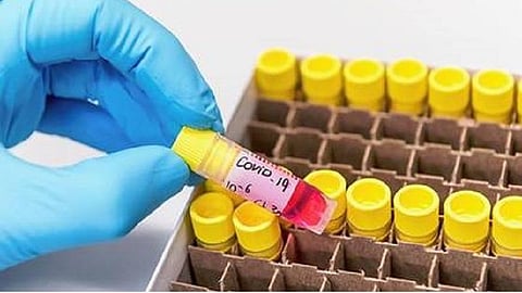 சென்னையில் இருந்து குமரி வந்த டிஜிபி அலுவலக ஊழியருக்கு கரோனா: பாதிப்பு எண்ணிக்கை 65 ஆக உயர்வு