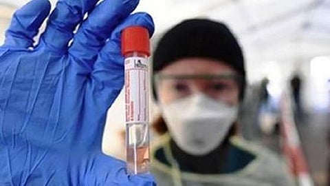 காரைக்குடியைச் சேர்ந்த உளவுப்பிரிவு காவலருக்கு கரோனா