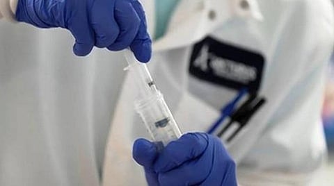 சென்னையில் இருந்து பிற மாவட்டங்களுக்கு செல்பவர்கள் கட்டாயம் கரோனா பரிசோதனை செய்ய வேண்டும்- தமிழக அரசு அரசாணை வெளியீடு